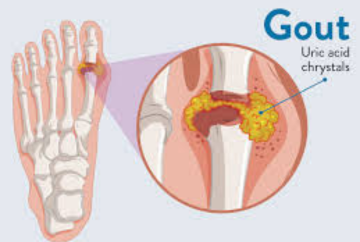 info-image